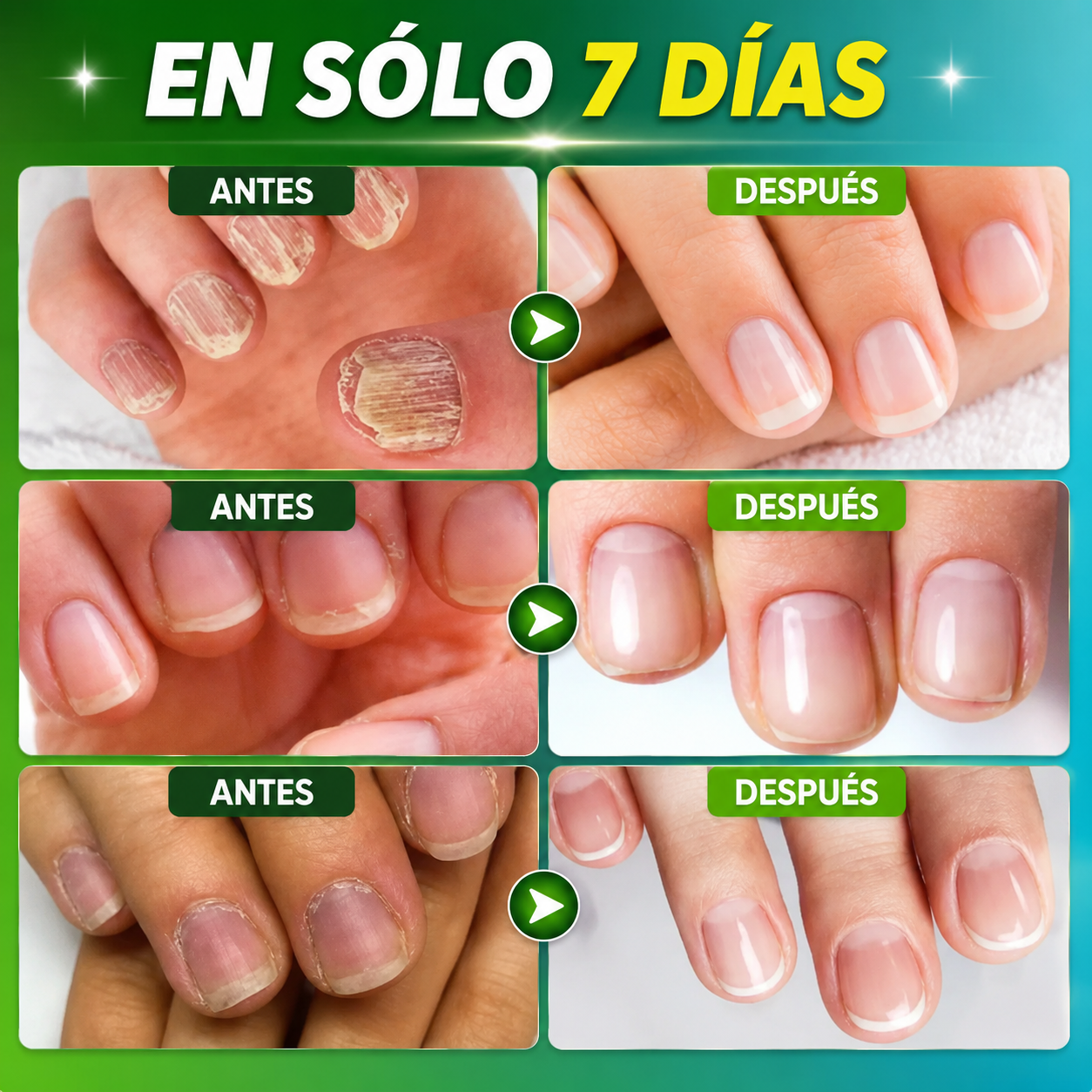 COMBO BASES ENDURECEDORA UÑAS DE TITANIO x 3